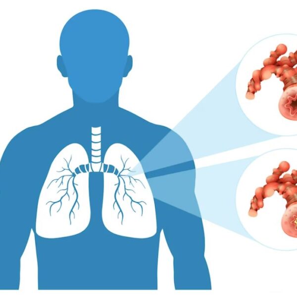 অষ্টম শ্রেণির এসাইনমেন্ট বিজ্ঞান